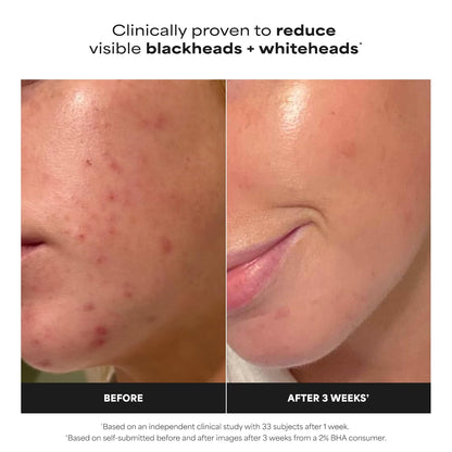 2% BHA Liquid Exfoliant