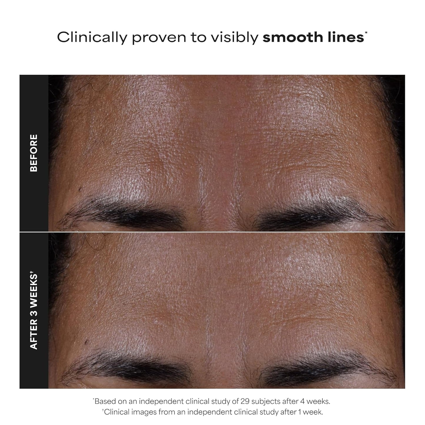 2% BHA Liquid Exfoliant