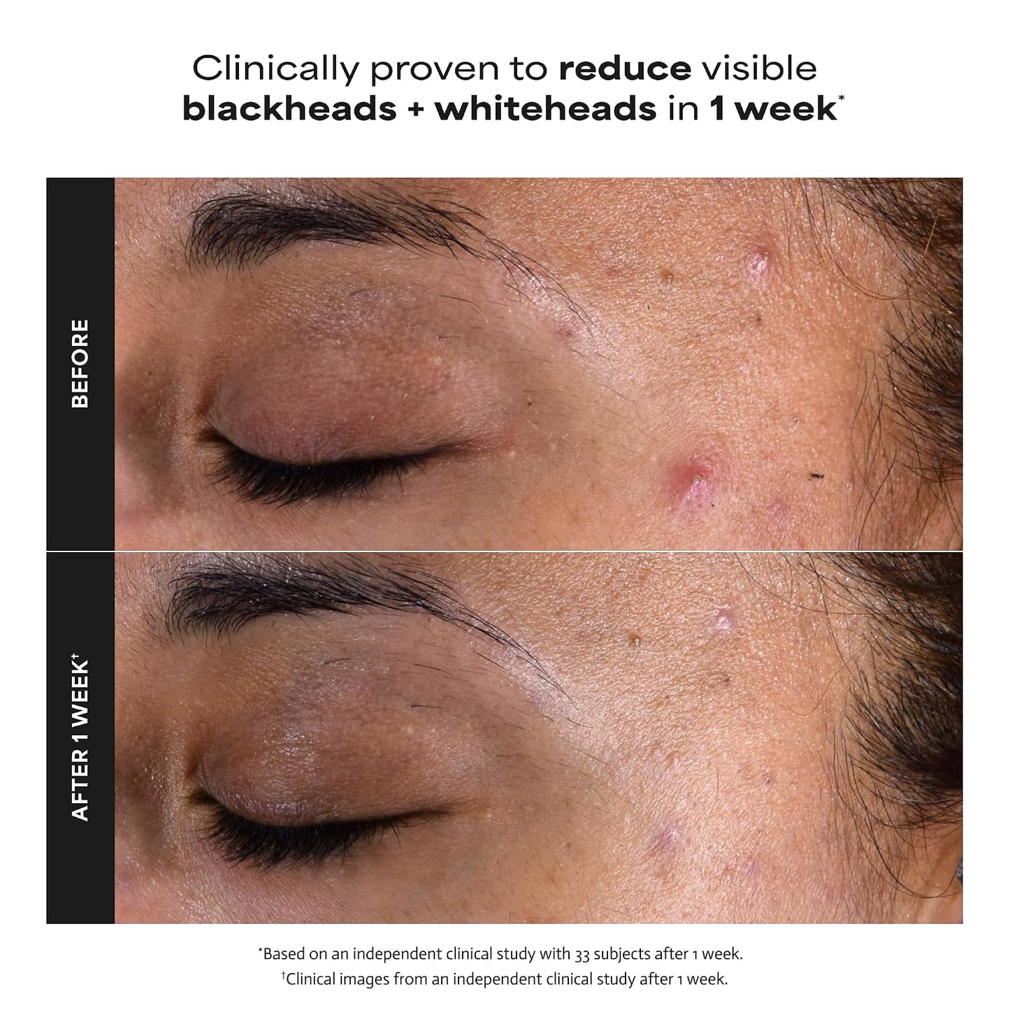2% BHA Liquid Exfoliant